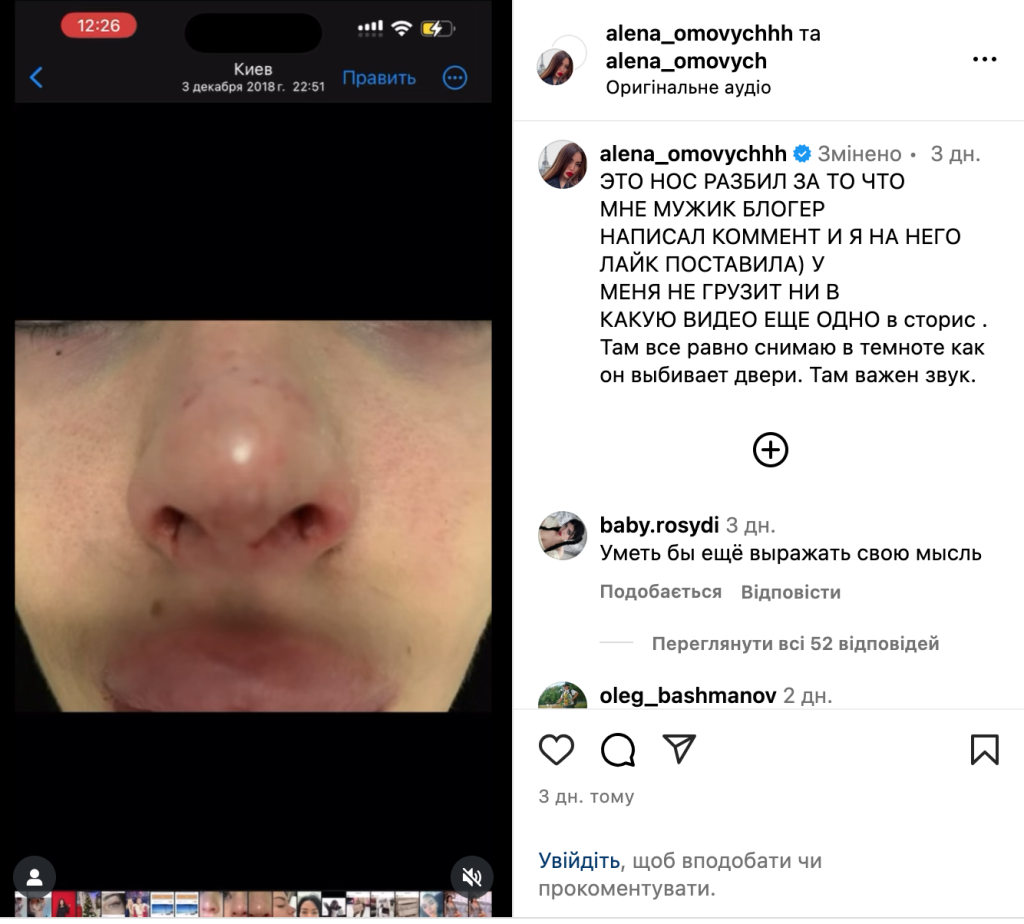 Хто така Альона Омович: зріст, вага, груди, OnlyFans та Instagram